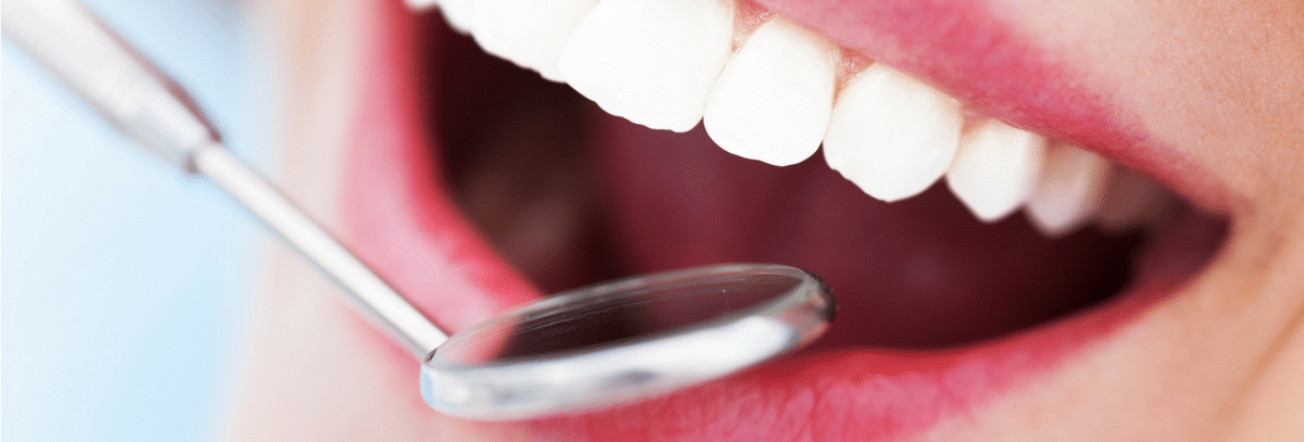 Dental Veneers Vs. Dental Bonding: What’s The Difference?