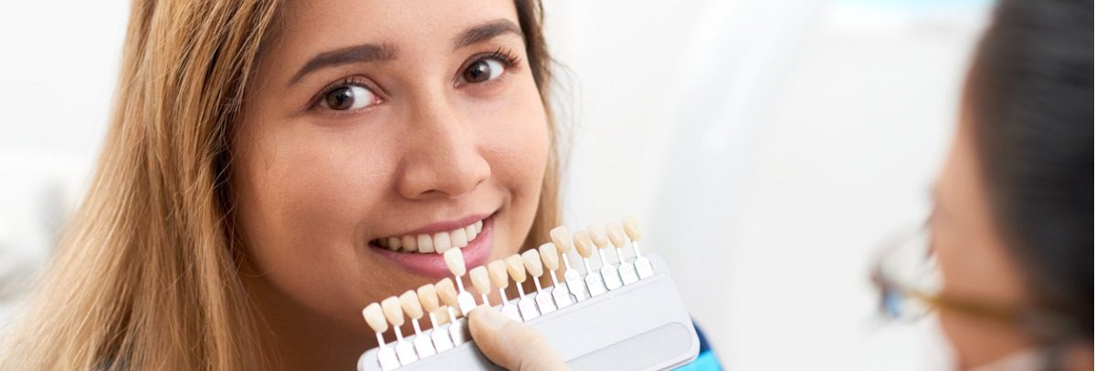 4 Reasons To Choose Dental Veneers