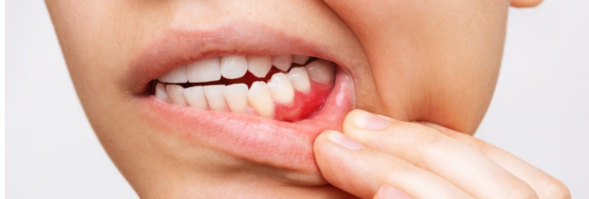 Common Dental Health Pitfalls To Avoid