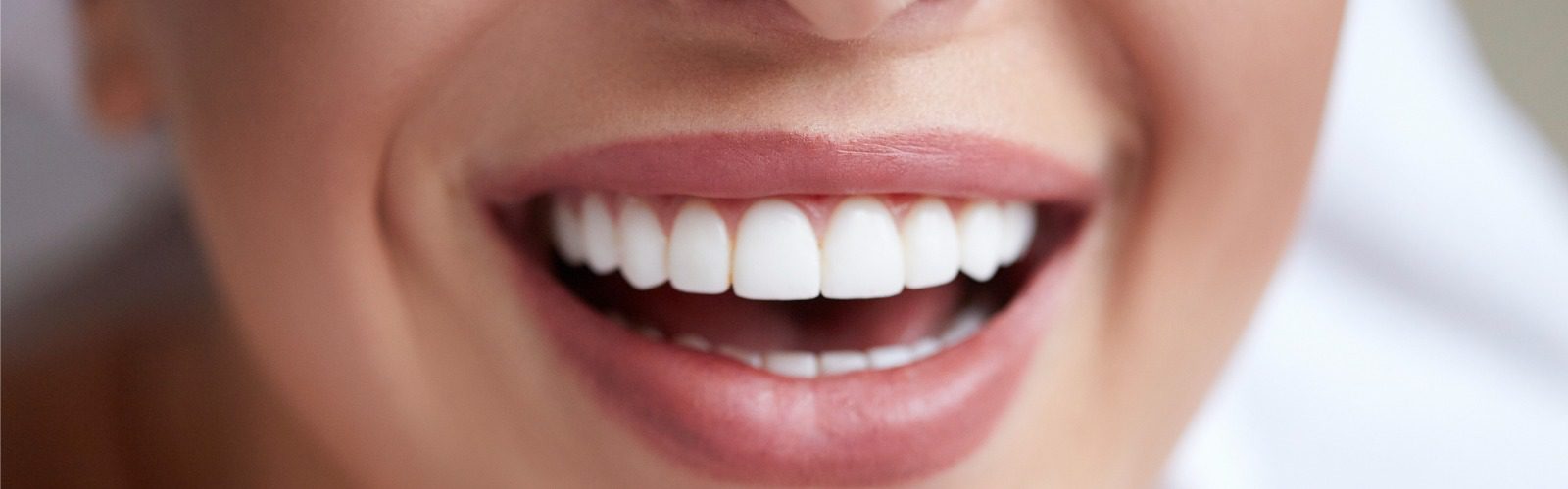 Aftercare Tips For Professional Teeth Whitening