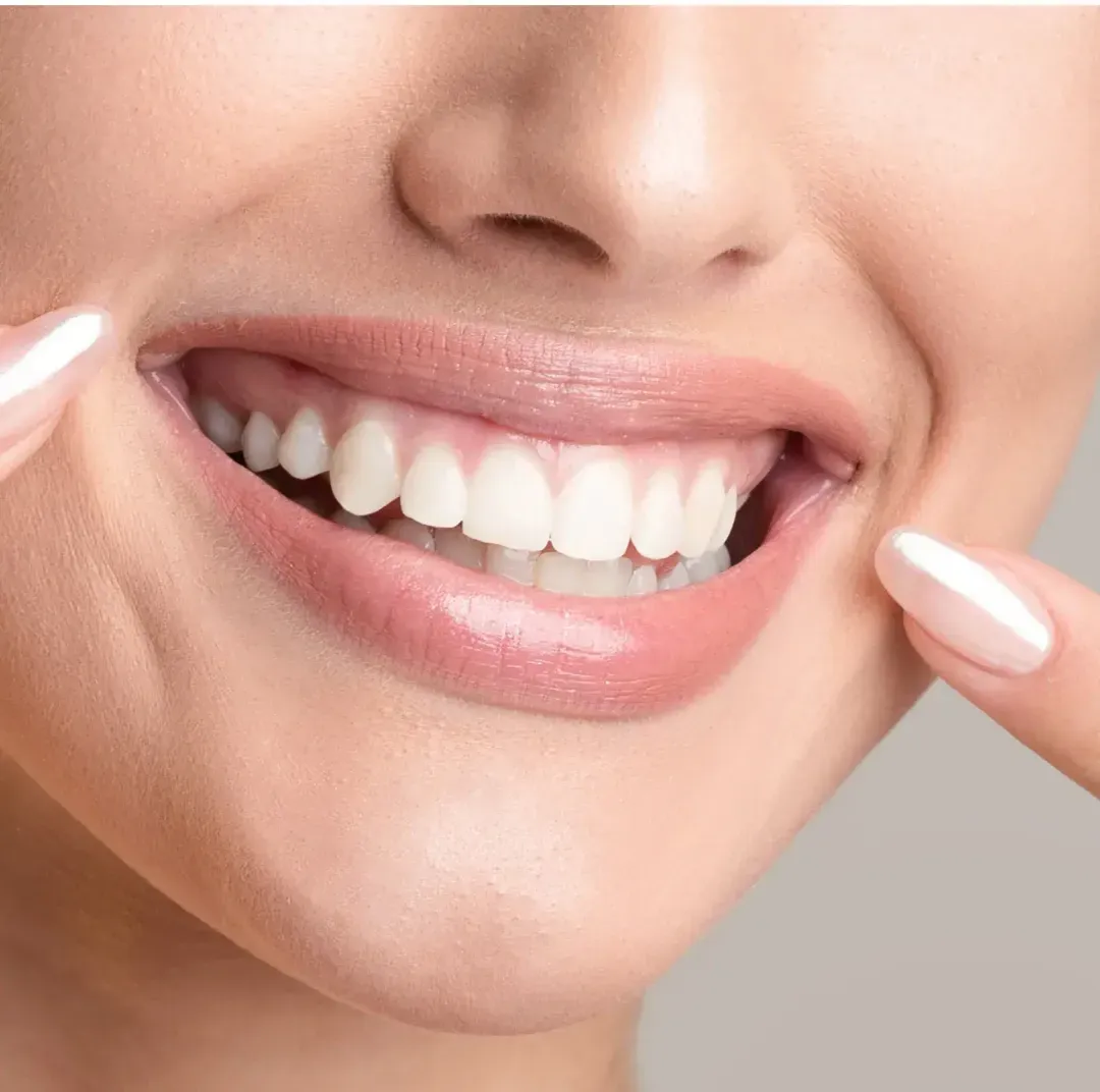 Teeth Whitening