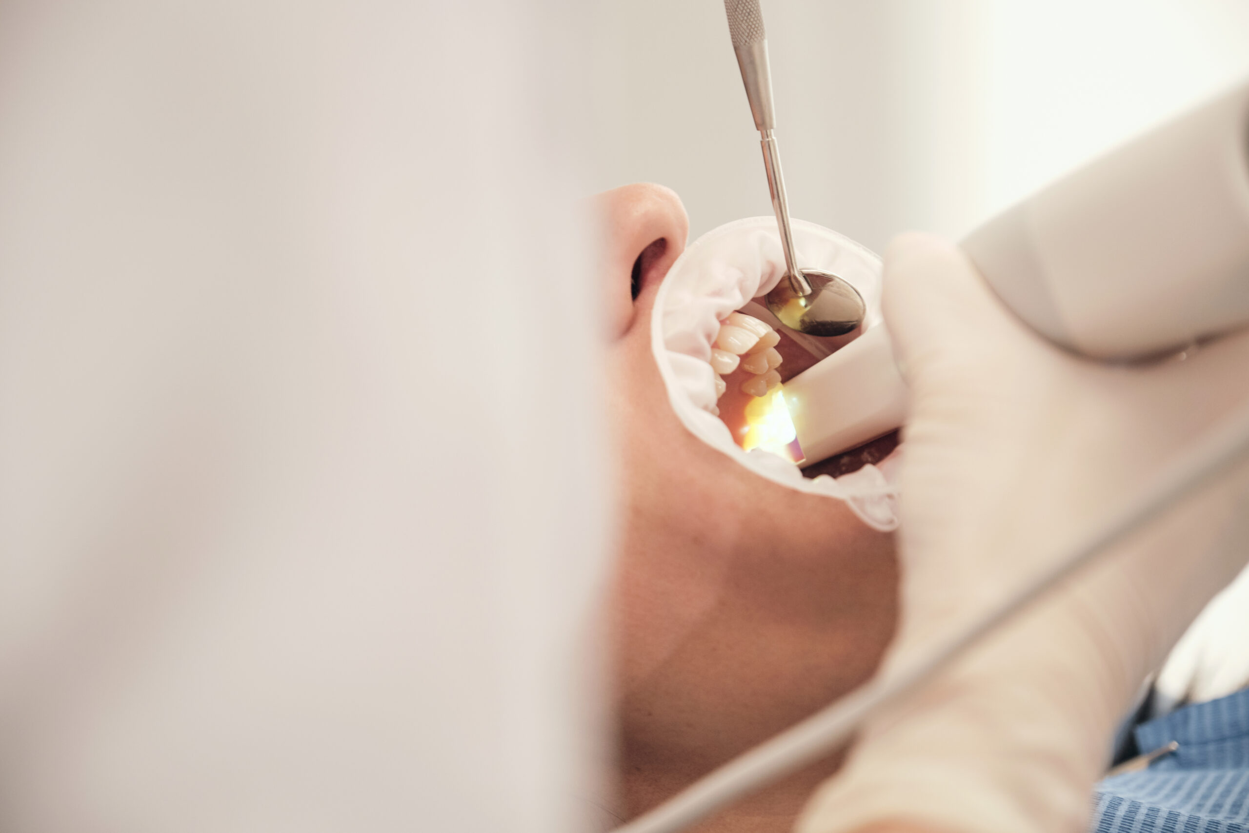 Root Canal Treatment